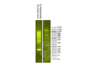 Histone 3 抗体  (H3K27ac)