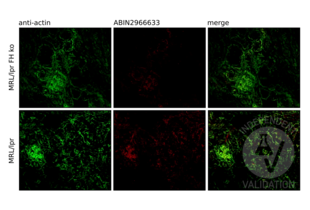 Immunofluorescence validation image for anti-Four and A Half LIM Domains 1 (FHL1) antibody (ABIN2966633) (FHL1 抗体)