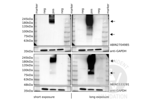 Western Blotting validation image for anti-Glutamate Receptor, Metabotropic 6 (GRM6) (C-Term) antibody (ABIN2704985) (Metabotropic Glutamate Receptor 6 抗体  (C-Term))