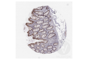 Immunohistochemistry validation image for anti-Hepatitis A Virus Cellular Receptor 1 (HAVCR1) (AA 332-348), (C-Term) antibody (ABIN3044226) (HAVCR1 抗体  (C-Term))