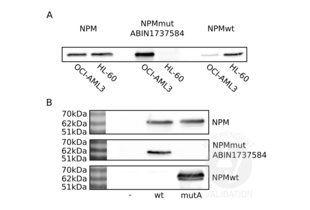 Western Blotting validation image for anti-Nucleophosmin (Nucleolar phosphoprotein B23, Numatrin) (NPM1) (AA 250-298), (C-Term) antibody (ABIN1737584) (NPM1 抗体  (C-Term))