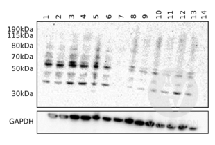Western Blotting validation image for anti-Complement Component C9 (C9) (AA 191-220), (Center) antibody (ABIN657704) (C9 抗体  (Center))