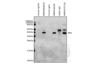 Immunoprecipitation validation image for anti-Major Histocompatibility Complex, Class I-Related (MR1) (AA 312-341), (C-Term) antibody (ABIN1537116)
