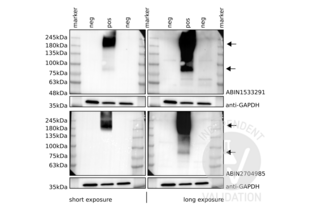Western Blotting validation image for anti-Glutamate Receptor, Metabotropic 6 (GRM6) (AA 828-877) antibody (ABIN1533291) (Metabotropic Glutamate Receptor 6 抗体  (AA 828-877))