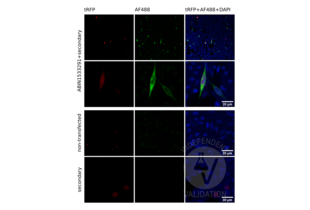 Immunofluorescence validation image for anti-Glutamate Receptor, Metabotropic 6 (GRM6) (AA 828-877) antibody (ABIN1533291) (Metabotropic Glutamate Receptor 6 抗体  (AA 828-877))