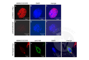 Immunocytochemistry validation image for anti-Myc Proto-Oncogene protein (MYC) (AA 31-80) antibody (ABIN1532205) (c-MYC 抗体  (AA 31-80))