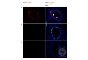 Immunofluorescence validation image for anti-Cytochrome P450, Family 4, Subfamily B, Polypeptide 1 (CYP4B1) (N-Term) antibody (ABIN2777006) (CYP4B1 抗体  (N-Term))