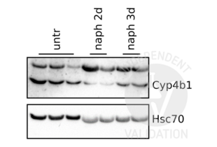 Western Blotting validation image for anti-Cytochrome P450, Family 4, Subfamily B, Polypeptide 1 (CYP4B1) (N-Term) antibody (ABIN2777006) (CYP4B1 抗体  (N-Term))