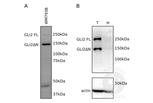 Western Blotting validation image for anti-GLI Family Zinc Finger 2 (GLI2) (Middle Region) antibody (ABIN2777474) (GLI2 抗体  (Middle Region))