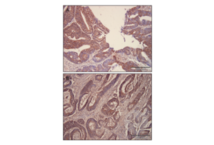 Immunohistochemistry validation image for anti-GLI Family Zinc Finger 2 (GLI2) (Middle Region) antibody (ABIN2777474) (GLI2 抗体  (Middle Region))
