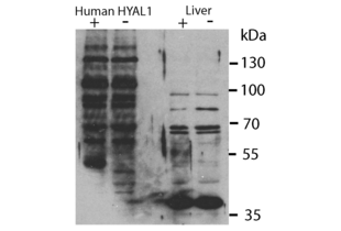Western Blotting validation image for anti-Hyaluronidase-1 (HYAL1) (N-Term) antibody (ABIN2784342) (HYAL1 抗体  (N-Term))