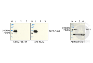 Western Blotting validation image for anti-Plakophilin 2 (PKP2) (N-Term) antibody (ABIN2786784) (Plakophilin 2 抗体  (N-Term))