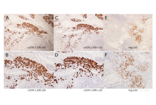 Immunohistochemistry validation image for anti-Colony Stimulating Factor 1 Receptor (CSF1R) (pTyr723) antibody (ABIN683788) (CSF1R 抗体  (pTyr723))