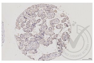 Immunohistochemistry validation image for anti-Mitogen-Activated Protein Kinase 14 (MAPK14) (pThr180), (pTyr182) antibody (ABIN678668) (MAPK14 抗体  (pThr180, pTyr182))