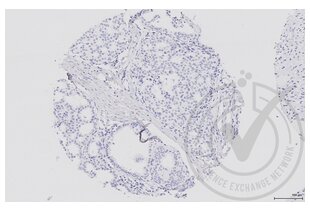 Immunohistochemistry validation image for anti-Mitogen-Activated Protein Kinase Kinase 5 (MAP2K5) (AA 251-350) antibody (ABIN754183) (MAP2K5 抗体  (AA 251-350))