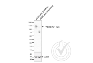 Western Blotting validation image for anti-Partner and Localizer of BRCA2 (PALB2) (AA 1101-1186) antibody (ABIN670536) (PALB2 抗体  (AA 1101-1186))