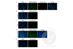 Immunofluorescence validation image for anti-Plakophilin 2 (PKP2) (AA 801-881) antibody (ABIN1386389) (Plakophilin 2 抗体  (AA 801-881))