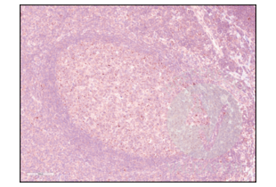 Immunohistochemistry validation image for anti-Programmed Cell Death 1 (PDCD1) (AA 201-288) antibody (ABIN735608) (PD-1 抗体  (AA 201-288))