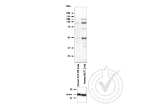 Western Blotting validation image for anti-Retinoblastoma 1 (RB1) (pSer795) antibody (ABIN712946) (Retinoblastoma 1 抗体  (pSer795))