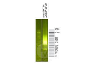 Cleavage Under Targets and Release Using Nuclease validation image for anti-Signal Transducer and Activator of Transcription 5A (STAT5A) antibody (ABIN5557532) (STAT5A 抗体)