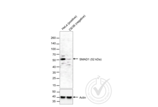 Western Blotting validation image for anti-Smad1/5 Protein (SMAD1/5) (AA 361-465) antibody (ABIN732158) (Smad1/5 抗体  (AA 361-465))