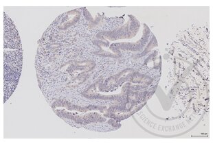 Immunohistochemistry validation image for anti-V-Raf-1 Murine Leukemia Viral Oncogene Homolog 1 (RAF1) (AA 31-130) antibody (ABIN733208) (RAF1 抗体  (AA 31-130))