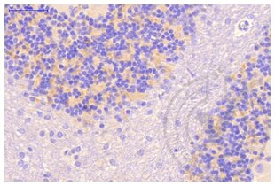 Immunohistochemistry validation image for anti-Clathrin (AA 4-171) antibody (ABIN968006) (Clathrin 抗体  (AA 4-171))
