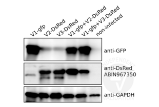 Western Blotting validation image for anti-Red Fluorescent Protein (RFP) antibody (ABIN967350) (RFP 抗体)