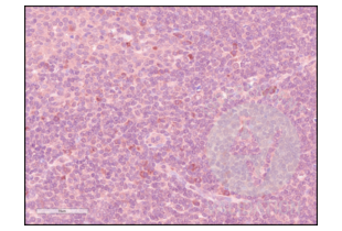 Immunohistochemistry validation image for anti-CD84 (CD84) (Internal Region) antibody (ABIN3187786) (CD84 抗体  (Internal Region))