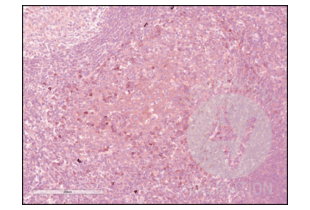 Immunohistochemistry validation image for anti-CD84 (CD84) (Internal Region) antibody (ABIN3187786) (CD84 抗体  (Internal Region))