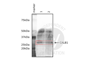 Western Blotting validation image for anti-Calbindin (CALB1) antibody (ABIN6254097) (CALB1 抗体)