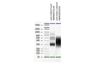Cleavage Under Targets and Release Using Nuclease validation image for anti-Catenin (Cadherin-Associated Protein), beta 1, 88kDa (CTNNB1) (N-Term) antibody (ABIN2855042) (CTNNB1 抗体  (N-Term))