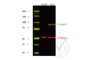 Western Blotting validation image for anti-Catenin, beta (CATNB) (C-Term) antibody (ABIN1043907) (beta Catenin 抗体  (C-Term))