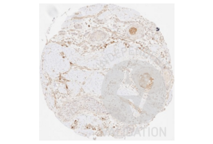 Immunohistochemistry validation image for anti-Collagen, Type III (COL3) antibody (ABIN5596830) (COL3 抗体)