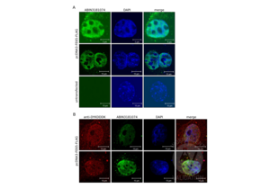 Immunocytochemistry validation image for anti-DYKDDDDK Tag antibody (ABIN3181074) (DYKDDDDK Tag 抗体)