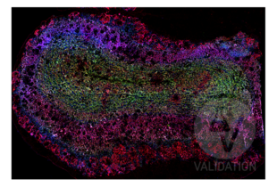 Multiplex Immunohistochemistry validation image for anti-Discs, Large Homolog 4 (Drosophila) (DLG4) antibody (ABIN361694) (DLG4 抗体)