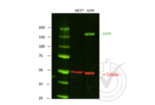 Western Blotting validation image for anti-Epidermal Growth Factor Receptor (EGFR) antibody (ABIN98862) (EGFR 抗体)