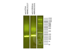 Cleavage Under Targets and Release Using Nuclease validation image for anti-Ets Variant 4 (ETV4) (AA 1-207) antibody (ABIN6131217) (ETV4 抗体  (AA 1-207))