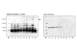 Western Blotting validation image for anti-Notch 2 (NOTCH2) (N-Term) antibody (ABIN1043688) (NOTCH2 抗体  (N-Term))