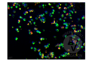Multiplex Immunohistochemistry validation image for anti-SARS-CoV-2 Spike S1 (RBD) antibody (ABIN6952546) (Recombinant SARS-CoV-2 Spike S1 抗体  (RBD))