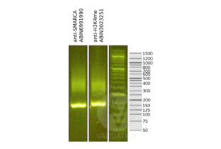 Cleavage Under Targets and Release Using Nuclease validation image for anti-SWI/SNF Related, Matrix Associated, Actin Dependent Regulator of Chromatin, Subfamily A, Member 4 (SMARCA4) (AA 1420-1470), (C-Term) antibody (ABIN6991990)