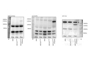 Western Blotting validation image for anti-alpha-Kinase 1 (ALPK1) (N-Term) antibody (ABIN3187581) (ALPK1 抗体  (N-Term))
