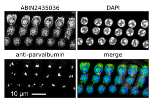 Immunofluorescence validation image for anti-Myosin VIIA (MYO7A) antibody (ABIN2435036) (Myosin VIIA 抗体)