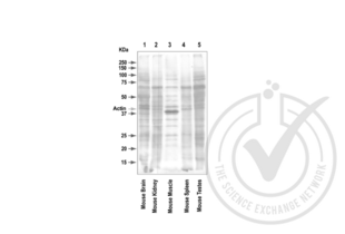 Western Blotting validation image for anti-Actin, beta (ACTB) (AA 2-16) antibody (ABIN1742508) (beta Actin 抗体  (AA 2-16))
