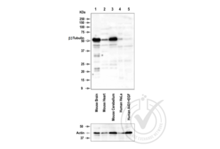 Western Blotting validation image for anti-Tubulin, beta 3 (TUBB3) (AA 443-450) antibody (ABIN1742553) (TUBB3 抗体  (AA 443-450))
