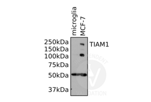 Western Blotting validation image for anti-T-Cell Lymphoma Invasion and Metastasis 1 (TIAM1) (AA 1-378) antibody (ABIN1982879) (TIAM1 抗体  (AA 1-378))