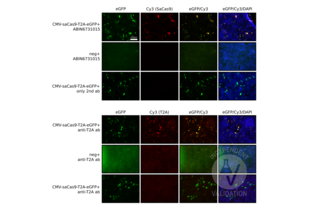 HEK293 cells transfected and not transfected with a plasmid expressing SaCas9-T2A-eGFP and stained with the anti-SaCas9 antibody ABIN6731015 (upper panels) or an anti-T2A antibody (lower panels). 