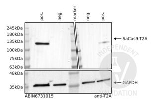 Western Blotting validation image for anti-CRISPR-Cas9 (AA 1-462) antibody (Sortase,His tag,AVI tag) (ABIN6731015) (Recombinant CRISPR-Cas9 (AA 1-462) 抗体 (Sortase,His tag,AVI tag))