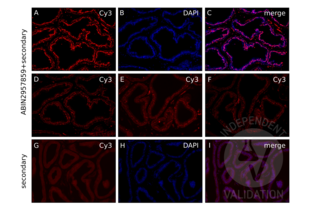 Immunofluorescence validation image for anti-Androgen Receptor (AR) antibody (ABIN2957859)