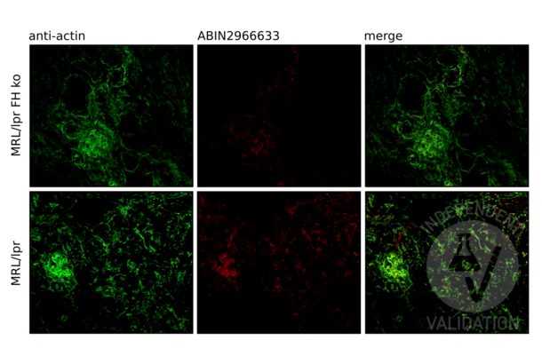 FHL1 antibody